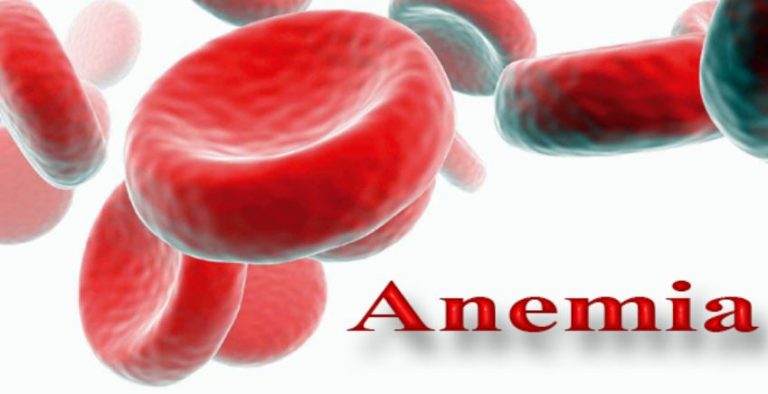 Pengertian dan Penyebab Terjadinya Anemia